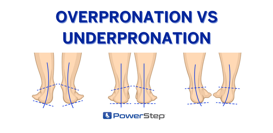 Overpronation vs Underpronation PowerStep Blog