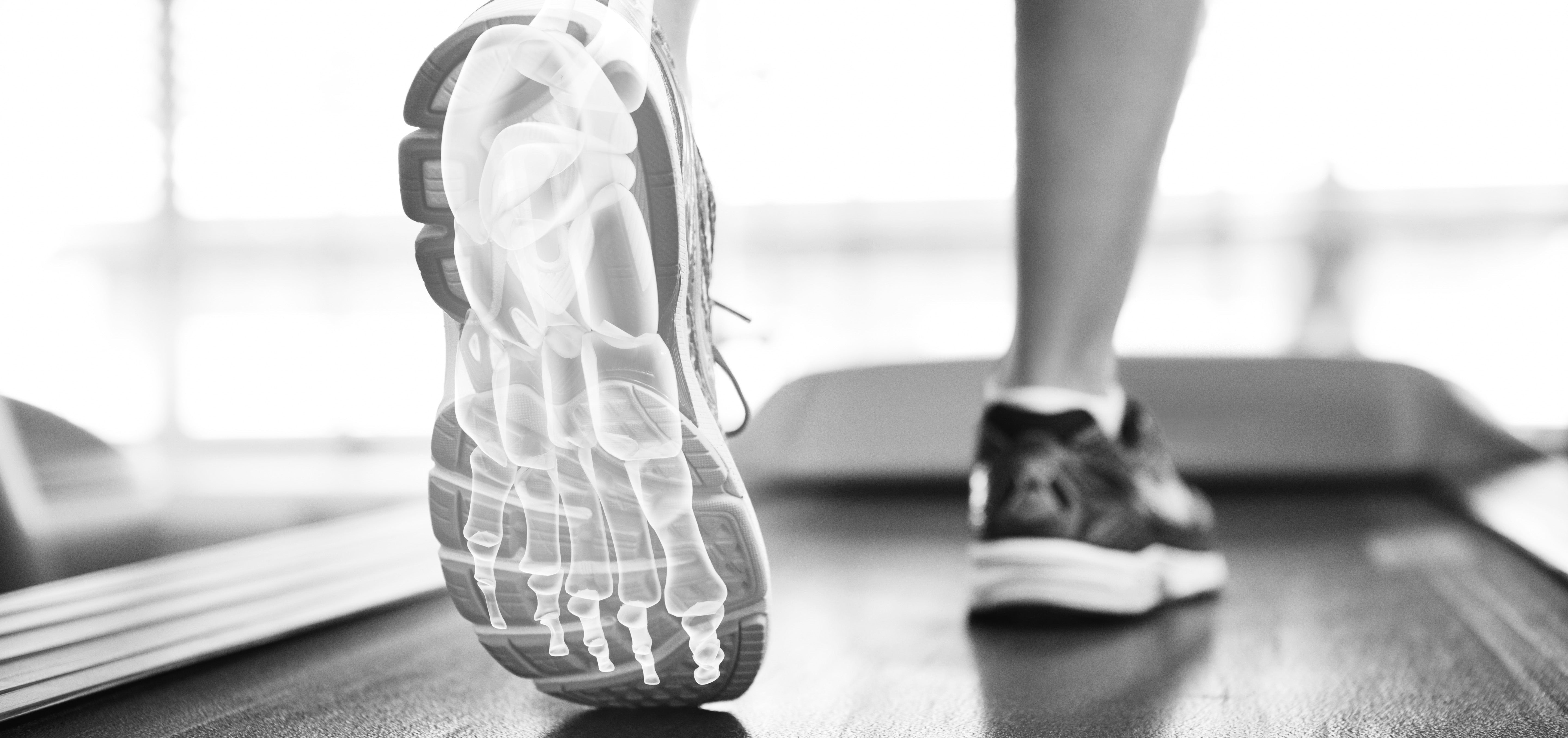 Shop Insoles by Foot Condition